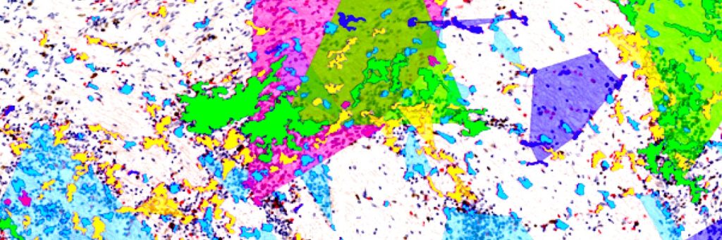 microglial cluster segmentation: brain tissue image